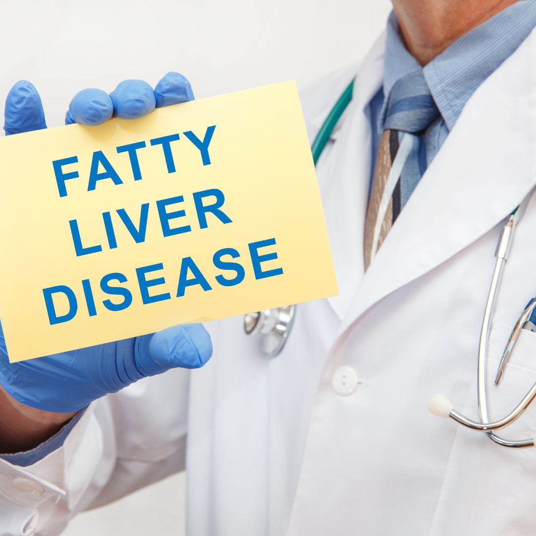 Fatty Liver Diet